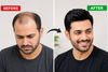 Men’s Hair Patch: Everything You Need to Know Before Buying (Complete Guide)